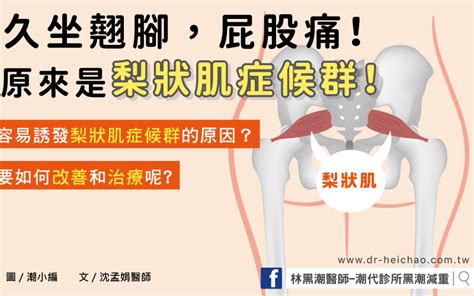 屁股位置|屁股痛恐是梨狀肌症候群！發炎多久會好？要看哪一科？